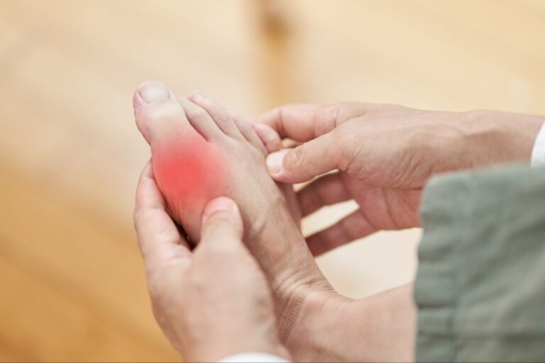 Shockwave Therapy Relieve Big Toe Joint Pain